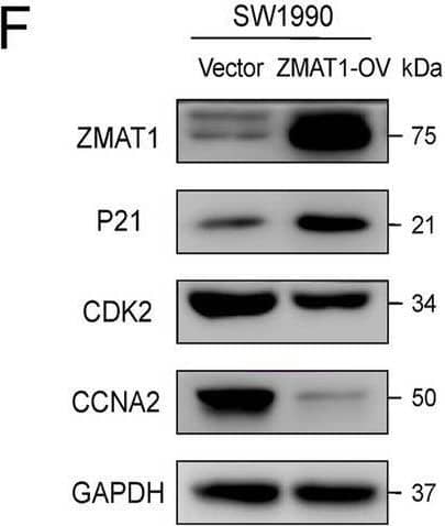Western Blot ZMAT1 Antibody - BSA Free