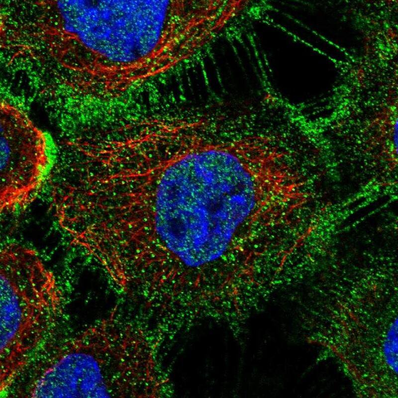 Staining of human cell line A-431 shows localization to nucleoplasm, plasma membrane & cell junctions.