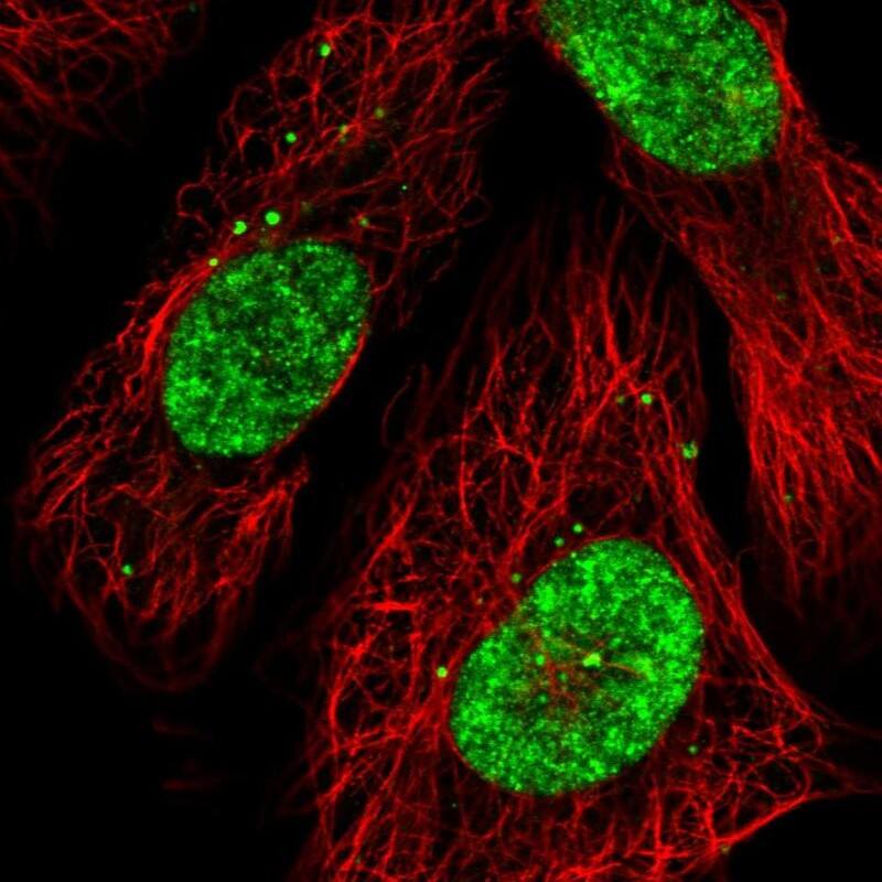 Staining of human cell line U-2 OS shows localization to nucleus & vesicles.