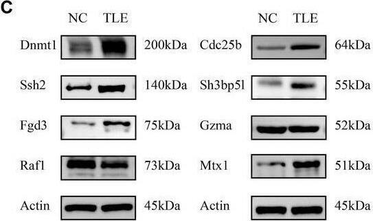 Expression of key genes at mRNA and protein levels in the hippocampus of TLE animal model. (A) Construction of the TLE mouse model. It primarily illustrates the process of animal anesthesia and fixation, kainic acid injection localization, brain tissue separation on ice, and hippocampus extraction. (B) Expression levels of core genes' corresponding mRNA in the hippocampus of NC and TLE groups identified by qPCR. Data are shown as mean +/- SE. (C) Western blot analysis of hippocampal lysates displaying the protein levels of Dnmt1, Cdc25b, Ssh2, Fgd3, Gzma, Raf1, and Mx1 with Actin serving as a loading control. Approximate molecular weights are indicated. (D) Quantification of Western blot analysis of the protein bands in Figure C, through relative gray values compared across NC and TLE hippocampus samples. (E) Quantitative analyses of immunofluorescence staining showing the fluorescence intensity between NC and TLE in Figure F. (F) Representative immunofluorescence images showing the hippocampal localization of Cdc25b, Raf1, Fgd3, Dnmt1, Mx1, and Ssh2 (red) with DAPI staining the nuclei (blue) in NC and TLE groups (Scale bar, 100 μm). (TLE, temporal lobe epilepsy; NC, normal control. *p < 0.05, **p < 0.01, ***p < 0.001, ns, not significant.) Image collected and cropped by CiteAb from the following open publication (//pubmed.ncbi.nlm.nih.gov/39753851), licensed under a CC-BY license. Not internally tested by Novus Biologicals.