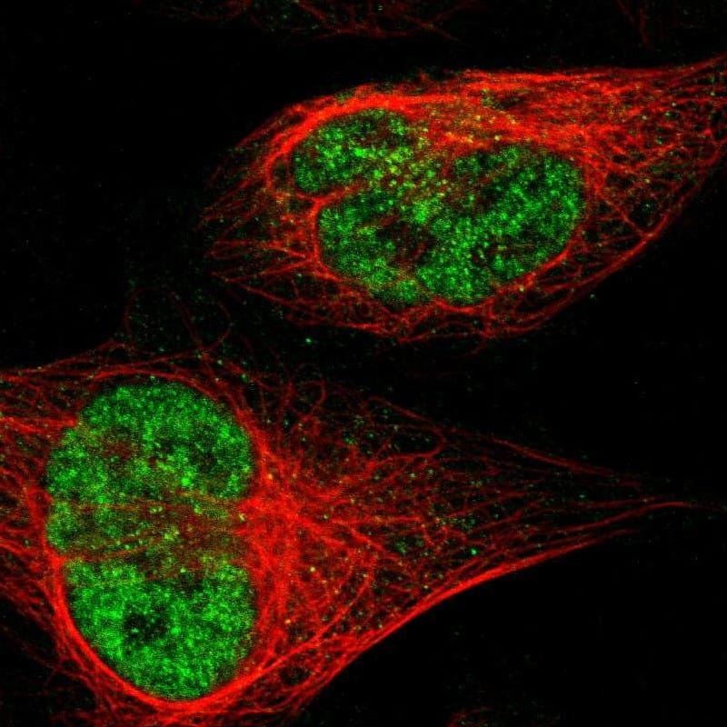 Immunocytochemistry/ Immunofluorescence JHDM1D Antibody - BSA Free