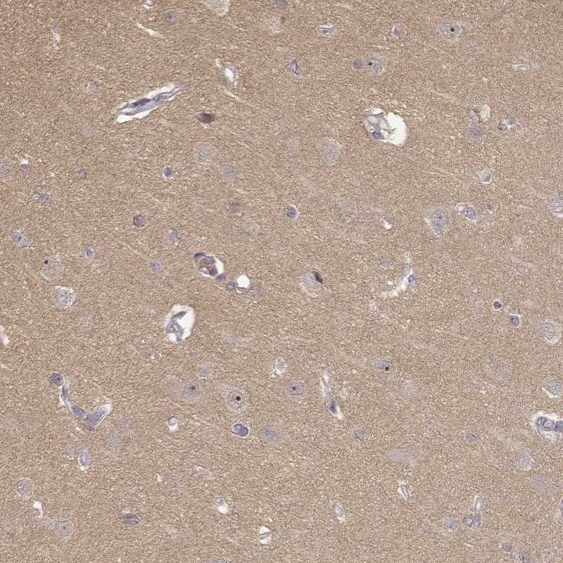 Immunohistochemistry-Paraffin MED12L Antibody - BSA Free