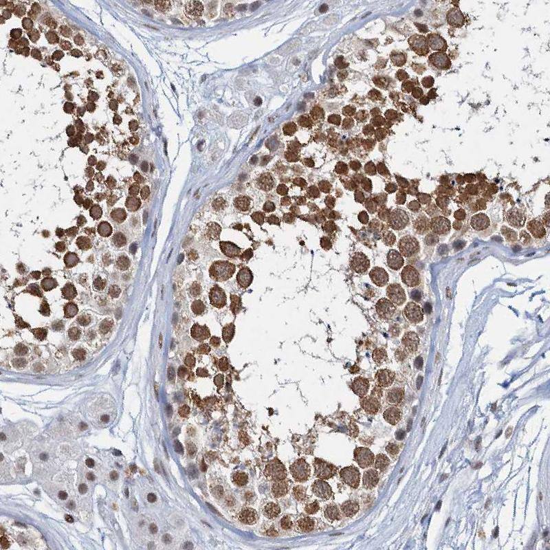 Staining of human testis shows moderate to strong nuclear positivity in cells in seminiferous ducts.
