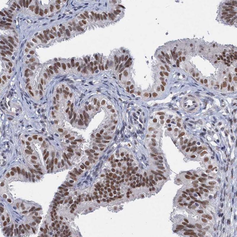 Staining of human fallopian tube shows strong nuclear positivity in glandular cells.