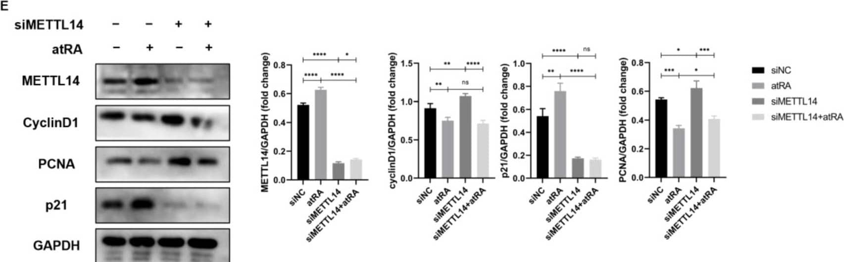 Knockdown of METTL14 or inhibition of m6A methylation modification can partially rescue the decline in cell proliferation induced by atRA. qRT-PCR (A) and Western blot (B) detection of the siRNA knockdown efficiency of METTL14. (C) Dot blotting detected the m6A methylation modification level of MEPM cells after treatment with siMETTL14 and atRA. (D) Flow cytometry to detect MEPM cell cycle changes after siMETTL14 and atRA treatments. (E) Western blot detected changes in MEPM cell cycle and proliferation-related proteins after siMETTL14 and atRA treatments. (F) Dot blotting detected m6A methylation modification level after SAH treatment of MEPM. (G) Western blot detection of METTL14 protein expression after SAH treatment of MEPM. (H) CCK8 experiment to detect cell proliferation after SAH and atRA treatments of MEPM. n.s is considered not statistically significant, * means p < 0.05, ** means p < 0.01, *** means p < 0.001, **** means p < 0.0001. Image collected and cropped by CiteAb from the following open publication (//www.mdpi.com/1422-0067/25/8/4538), licensed under a CC-BY license. Not internally tested by Novus Biologicals.