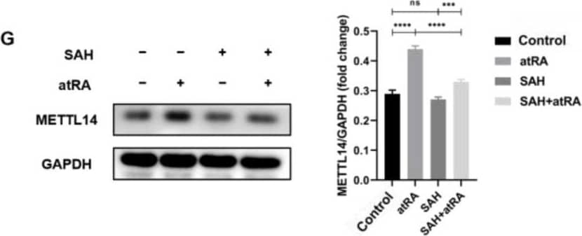 Knockdown of METTL14 or inhibition of m6A methylation modification can partially rescue the decline in cell proliferation induced by atRA. qRT-PCR (A) and Western blot (B) detection of the siRNA knockdown efficiency of METTL14. (C) Dot blotting detected the m6A methylation modification level of MEPM cells after treatment with siMETTL14 and atRA. (D) Flow cytometry to detect MEPM cell cycle changes after siMETTL14 and atRA treatments. (E) Western blot detected changes in MEPM cell cycle and proliferation-related proteins after siMETTL14 and atRA treatments. (F) Dot blotting detected m6A methylation modification level after SAH treatment of MEPM. (G) Western blot detection of METTL14 protein expression after SAH treatment of MEPM. (H) CCK8 experiment to detect cell proliferation after SAH and atRA treatments of MEPM. n.s is considered not statistically significant, * means p < 0.05, ** means p < 0.01, *** means p < 0.001, **** means p < 0.0001. Image collected and cropped by CiteAb from the following open publication (//www.mdpi.com/1422-0067/25/8/4538), licensed under a CC-BY license. Not internally tested by Novus Biologicals.