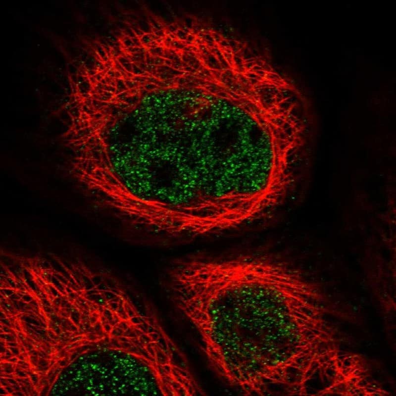 Staining of human cell line A-431 shows localization to nucleoplasm.
