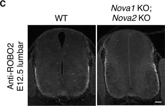 Immunohistochemistry: ROBO2 Antibody [NBP1-81399] - Lateral positioning of ROBO1-expressing longitudinal axons in Nova1/2 dKO embryos.(A) Anti-ROBO1 staining of transverse sections of E12.5 lumbar spinal cords. The antibodies do not distinguish between isoforms. ROBO1 was expressed at a low level on precrossing axons & was highly upregulated on postcrossing axons in both WT & Nova1/2 dKO embryos. ROBO1-expressing axons displayed the same lateral positioning defect as anti-L1 labeled axons (compare with Figure 4B). Reducing Robo1(e6b+) partially rescued the lateral positioning defect in Nova1/2 dKO embryos, while reducing Robo2(e6b+) alone did not rescue. Reducing Robo1/2(e6b+) together further rescued the defect. Arrows indicate the lateral funiculus (LF) & ventral funiculus (VF). Scale bar, 50 μm. (B) Quantification of the lateral positioning of ROBO1-expressing axons in A. Data are represented as the mean ± SD (one-way ANOVA & Bonferroni post test; animal numbers & p values are indicated; ns, not significant). (C) Anti-ROBO2 staining of transverse sections of E12.5 lumbar spinal cords. The antibodies do not distinguish between isoforms. ROBO2 was primarily expressed by axons in the lateral funiculi, & the overall patterns were comparable between the WT & Nova1/2 dKO embryos. (D) Anti-ROBO1 & anti-ROBO2 staining in the corresponding KO embryos, showing the specificity of the antibodies. The Robo1 KO was generated by trapping the protein product in intracellular compartments (Friedel et al., 2005). ROBO1 expression was seen in neuronal cell bodies but not in axons in Robo1 KO spinal cords, as previously reported (Long et al., 2004). Image collected & cropped by CiteAb from the following publication (//pubmed.ncbi.nlm.nih.gov/31392959), licensed under a CC-BY license. Not internally tested by Novus Biologicals.