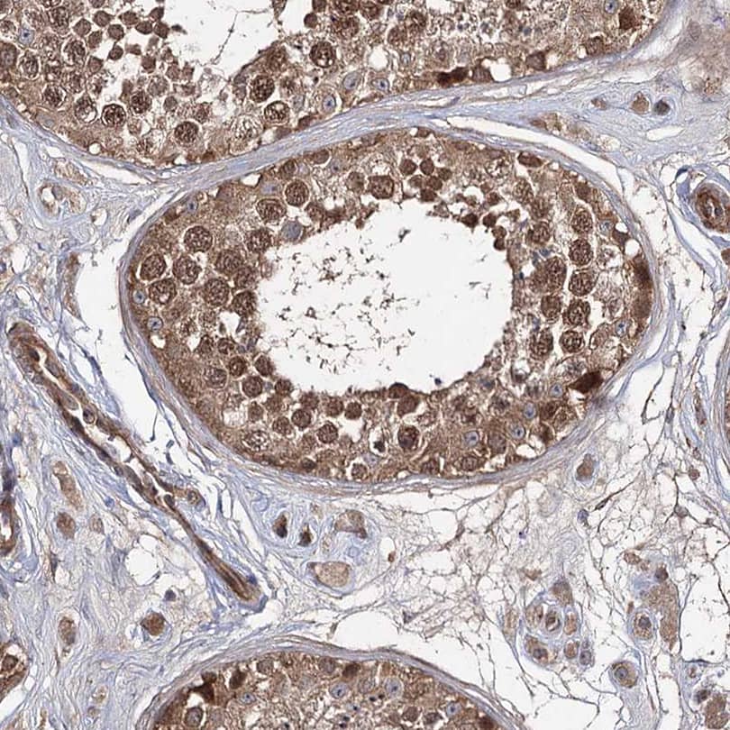 Staining of human testis shows moderate to strong positivity.