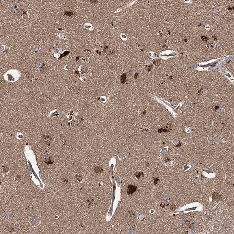 Staining of human cerebral cortex shows cytoplasmic positivity in neuronal cells.