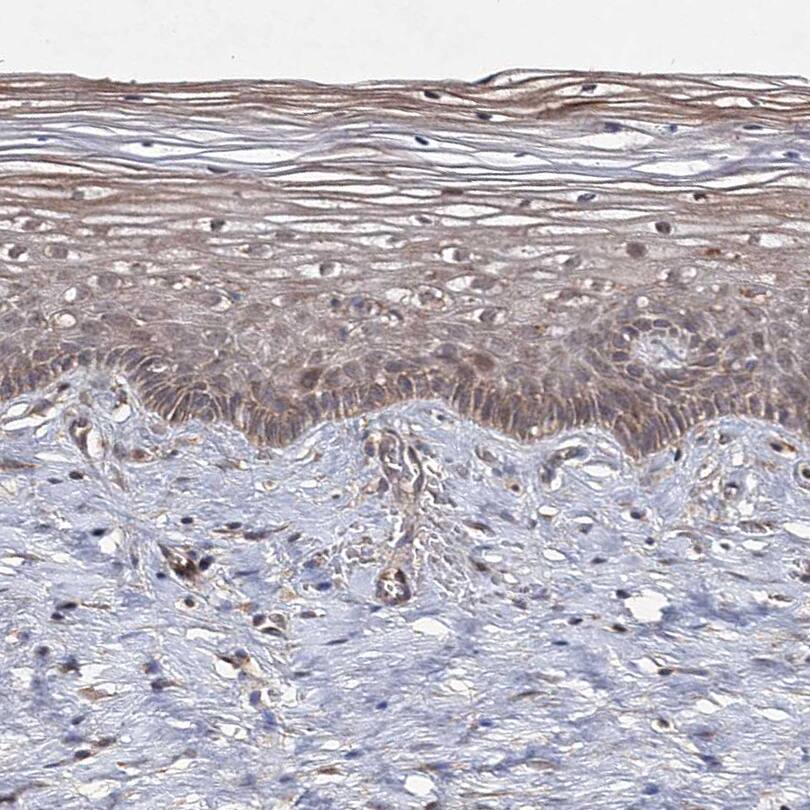 Staining of human cervix, uterine shows moderate cytoplasmic positivity in squamous epithelial cells.