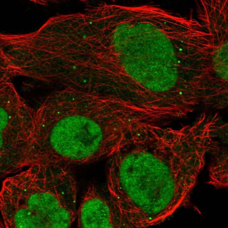 Staining of human cell line A-431 shows localization to nucleoplasm, nucleoli fibrillar center & vesicles.