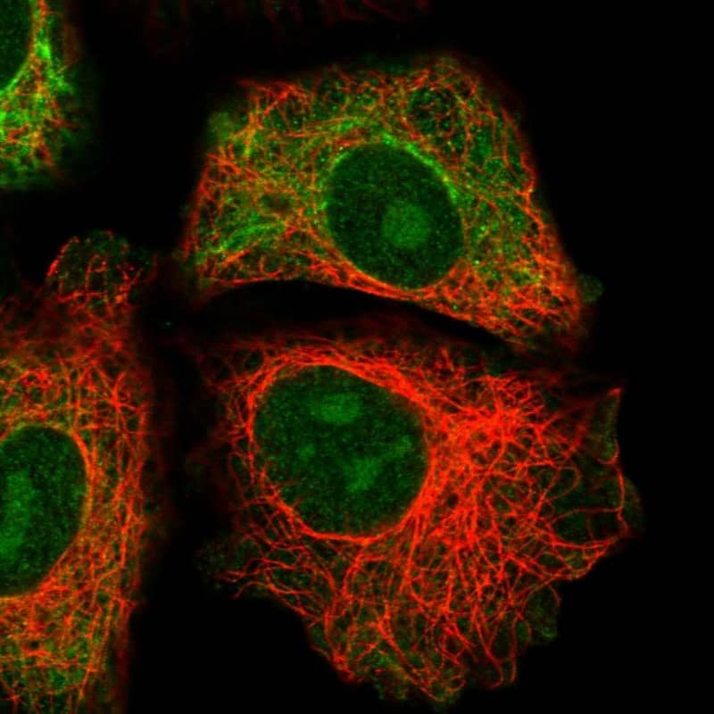 Immunocytochemistry/ Immunofluorescence GRAMD1B Antibody - BSA Free