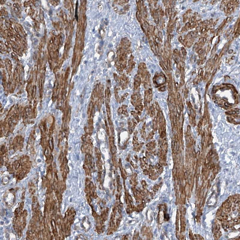 Staining of human smooth muscle shows strong cytoplasmic positivity in smooth muscle cells.