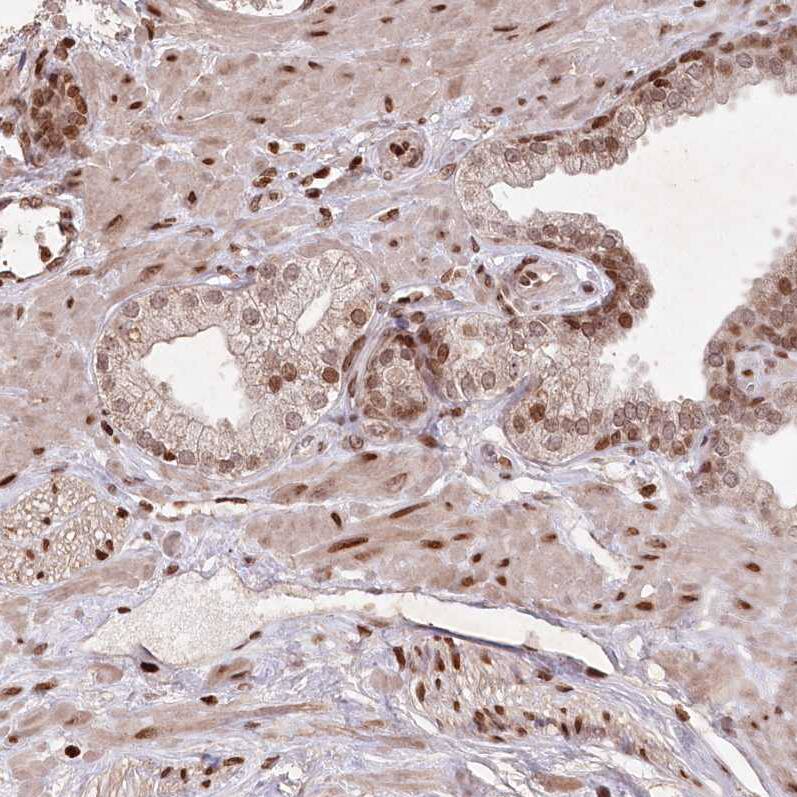 Staining of human prostate shows moderate to strong nuclear positivity in smooth muscle cells and glandular cells.
