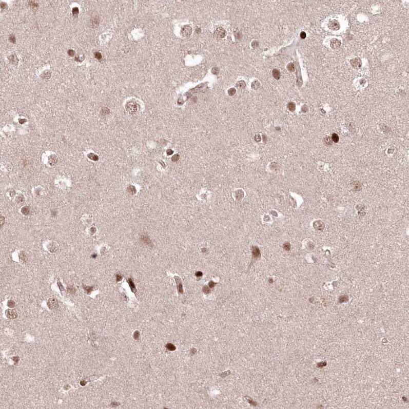 Staining of human cerebral cortex shows moderate nuclear positivity in glial cells.
