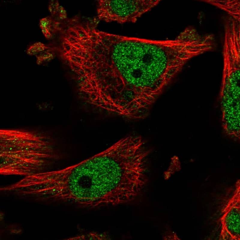 Staining of human cell line U-251 MG shows localization to nucleoplasm.