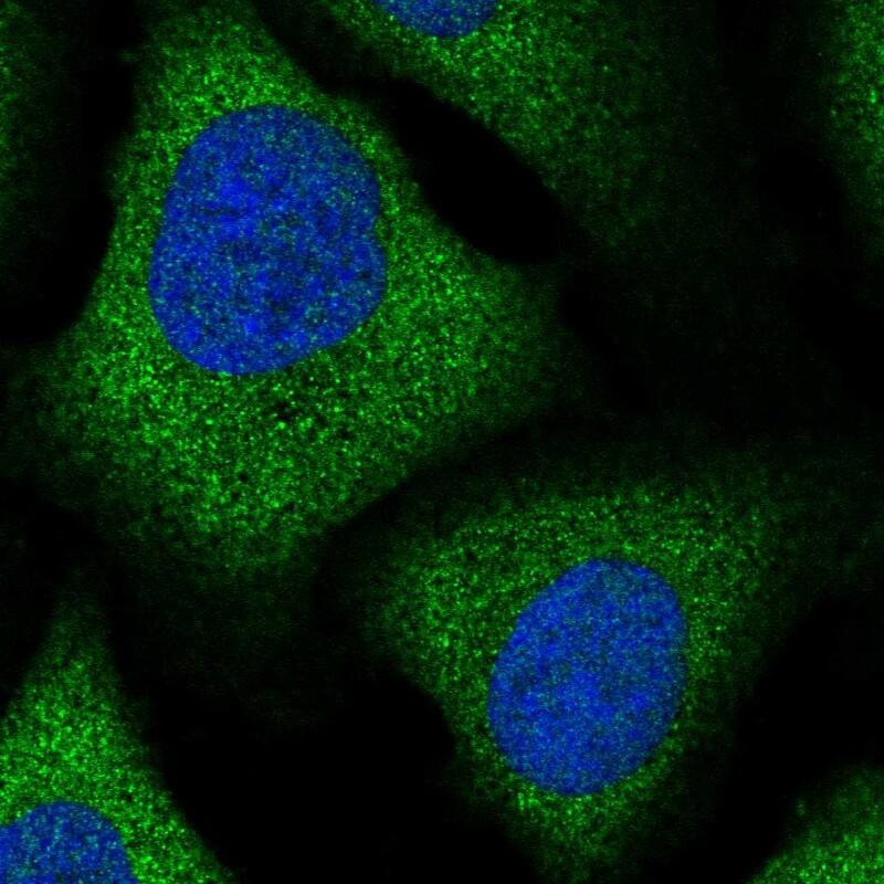 Staining of human cell line U-2 OS shows localization to cytosol.