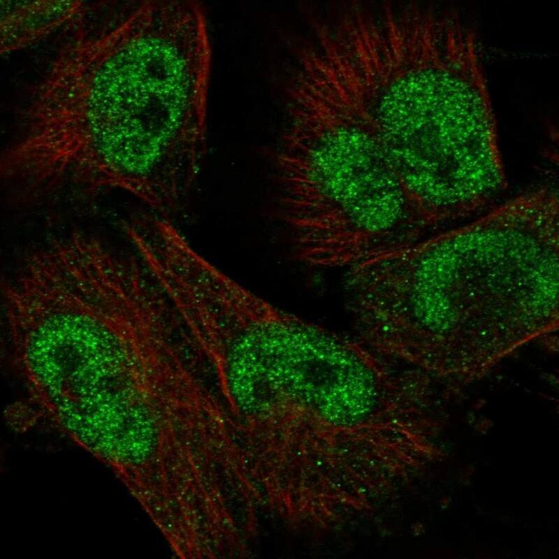 Immunocytochemistry/ Immunofluorescence UBOX5 Antibody - BSA Free