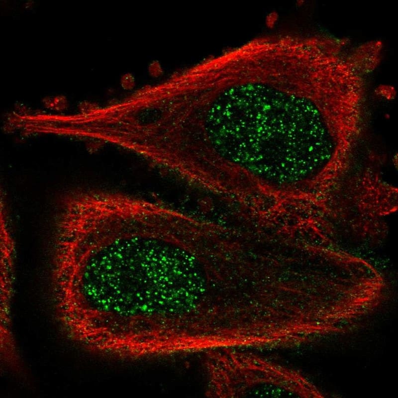 Immunocytochemistry/ Immunofluorescence ABLIM3 Antibody - BSA Free