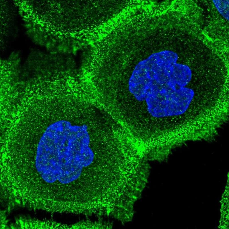 Staining of human cell line A-431 shows localization to nuclear speckles, plasma membrane & actin filaments.