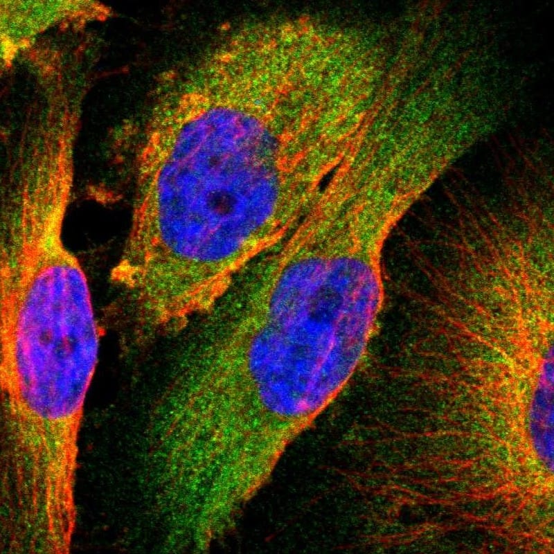 Staining of human cell line U-251 MG shows localization to cytosol.