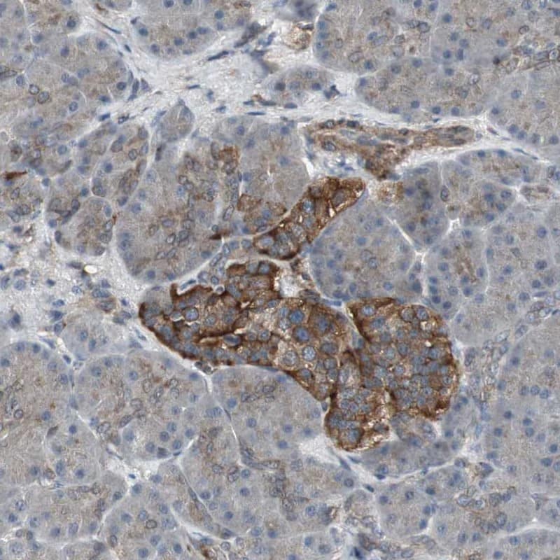 Staining of human pancreas shows strong cytoplasmic positivity in islet cells.