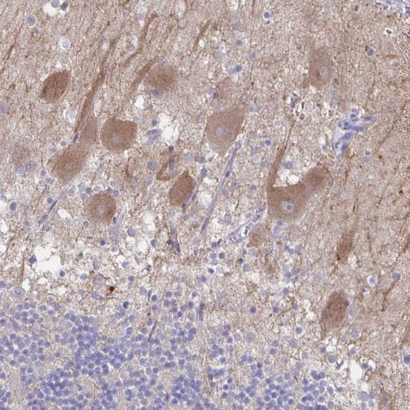 Staining of human cerebellum shows moderate cytoplasmic positivity in Purkinje cells.