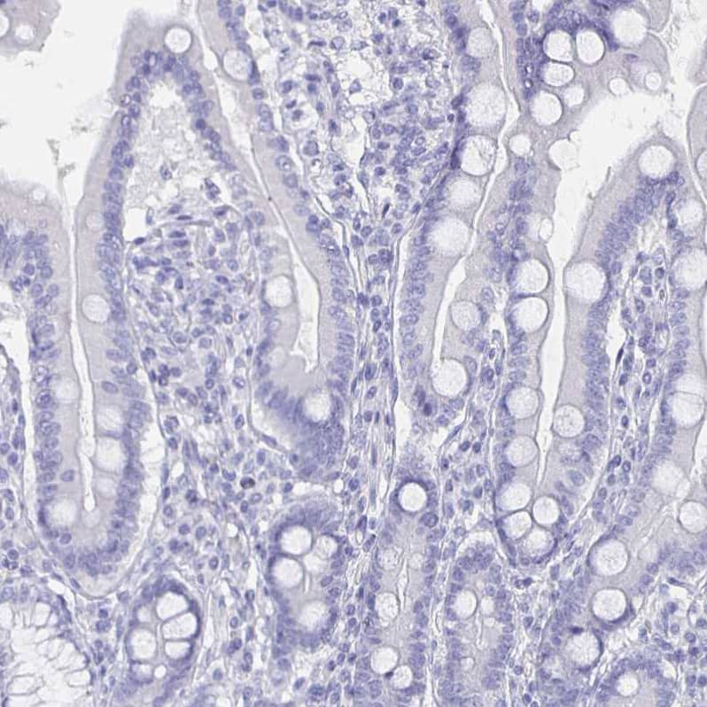 Staining of human duodenum shows no cytoplasmic positivity in glandular cells.