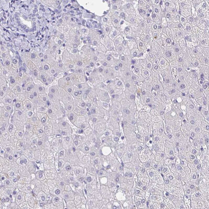 Staining of human liver shows no cytoplasmic positivity in hepatocytes as expected.