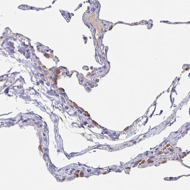 Staining of human lung shows moderate cytoplasmic positivity in pneumocytes.