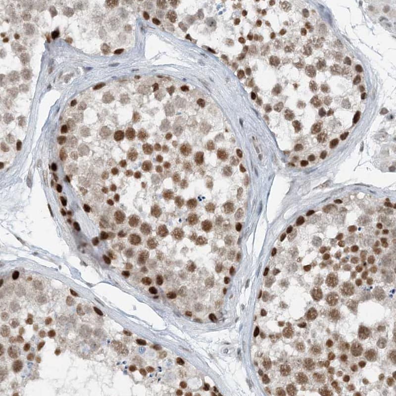 Staining of human testis shows strong nuclear positivity in cells in seminiferus ducts.