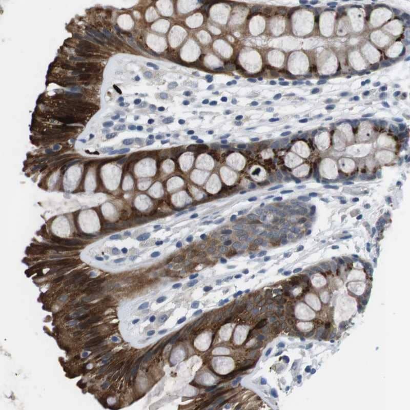 Staining of human colon shows strong cytoplasmic positivity in glandular cells.