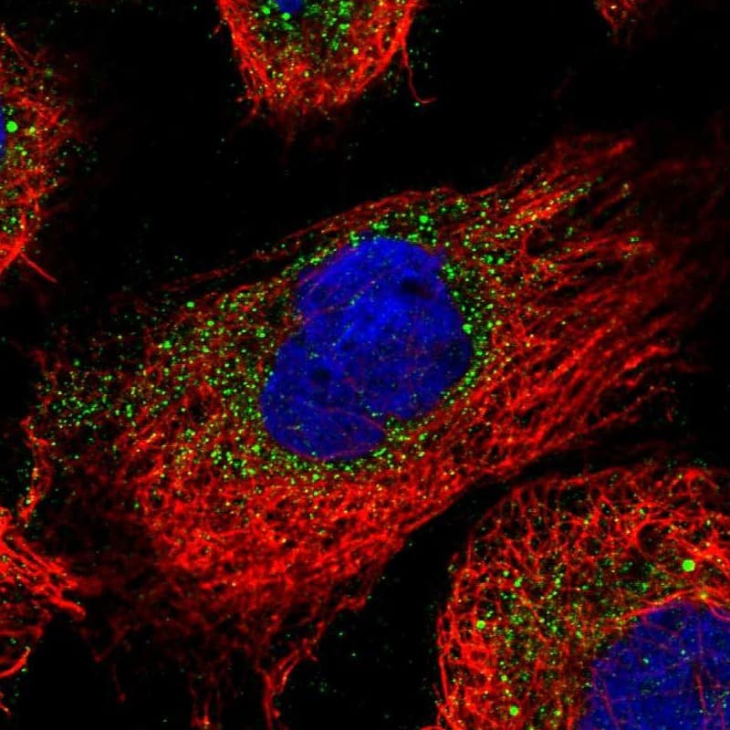 Immunocytochemistry/ Immunofluorescence ENTPD4 Antibody - BSA Free