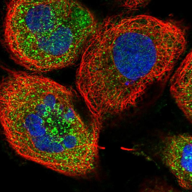 Immunocytochemistry/ Immunofluorescence ZFYVE16 Antibody - BSA Free