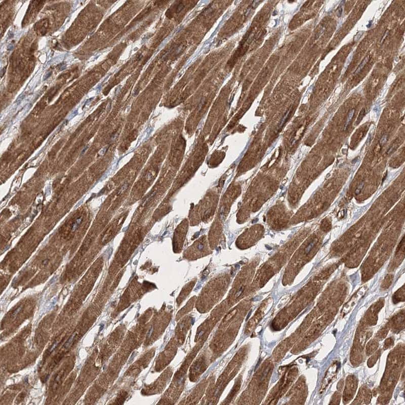 Staining of human heart muscle shows moderate cytoplasmic positivity in myocytes.