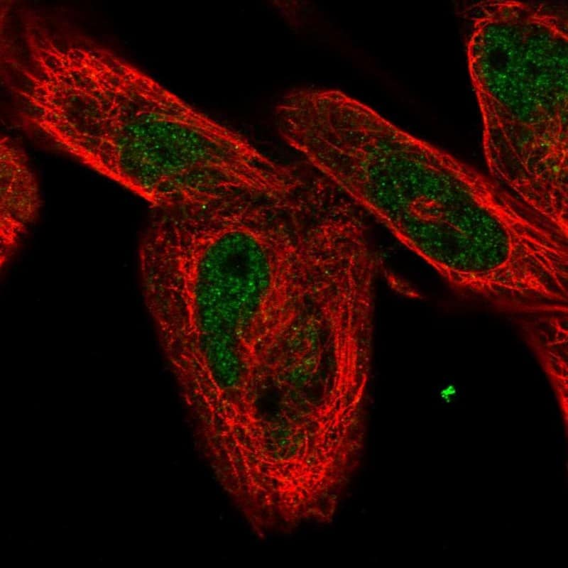 Staining of human cell line RH-30 shows localization to nucleoplasm.