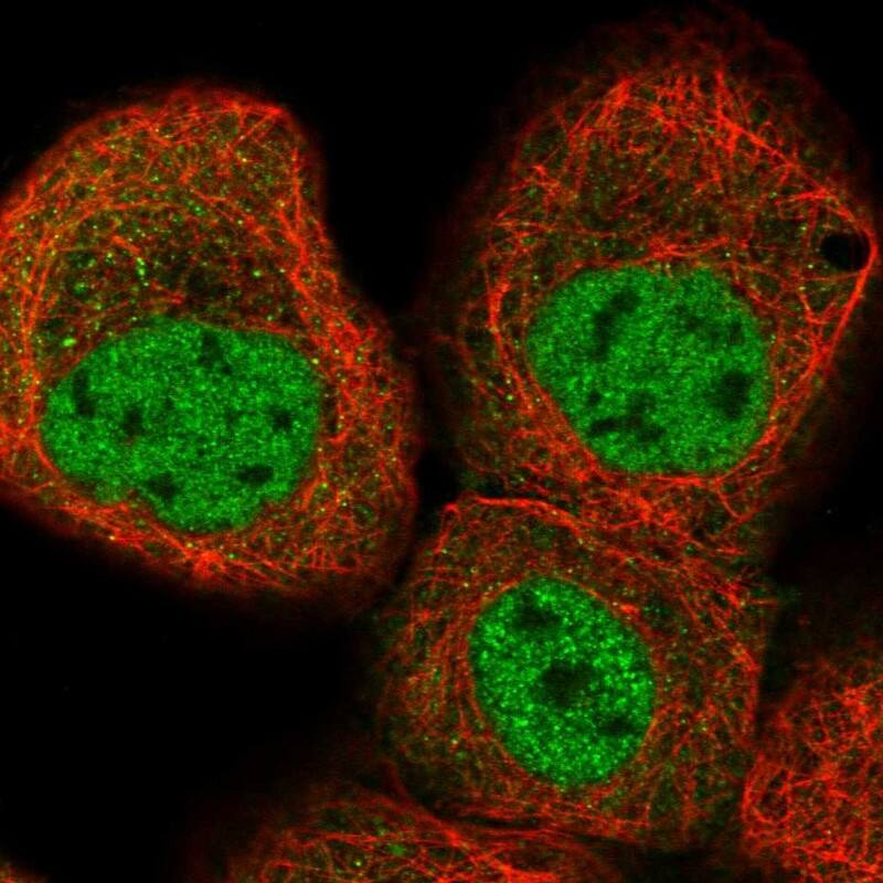 Staining of human cell line A-431 shows localization to nucleoplasm.