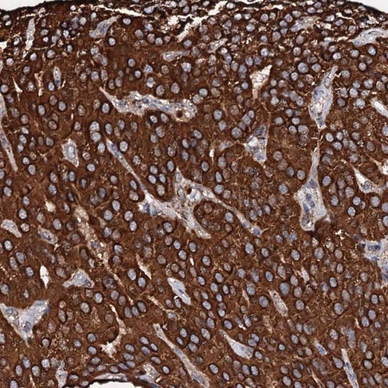 Staining of human parathyroid gland shows cytoplasmic positivity in glandular cells.