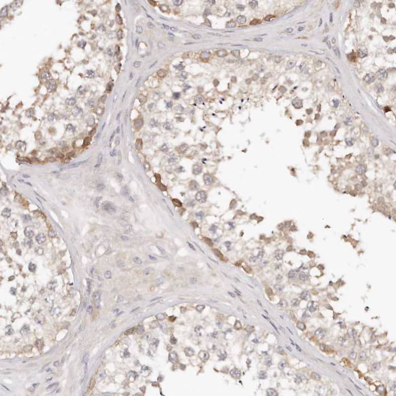 Immunohistochemistry-Paraffin TTLL4 Antibody - BSA Free