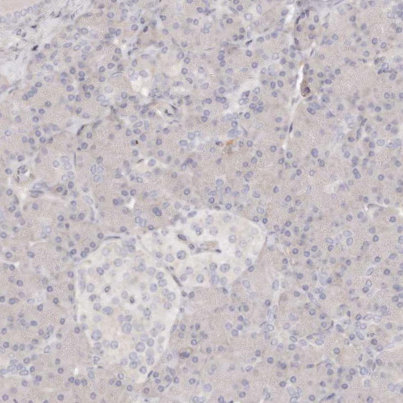Immunohistochemistry-Paraffin TTLL4 Antibody - BSA Free