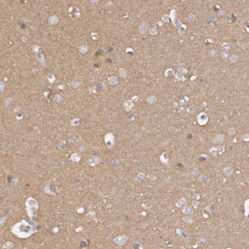Staining of human cerebral cortex shows moderate positivity in neuropil.