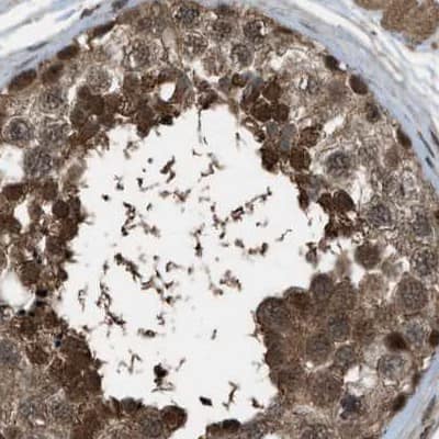 Immunohistochemistry-Paraffin SERTAD2 Antibody - BSA Free