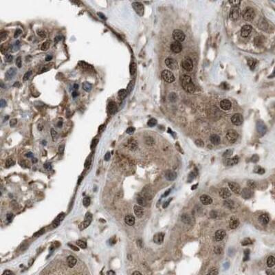 Immunohistochemistry-Paraffin SERTAD2 Antibody - BSA Free