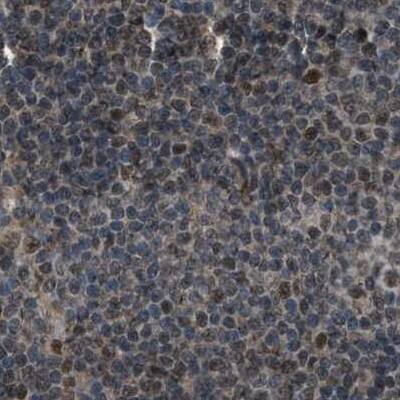 Immunohistochemistry-Paraffin SERTAD2 Antibody - BSA Free