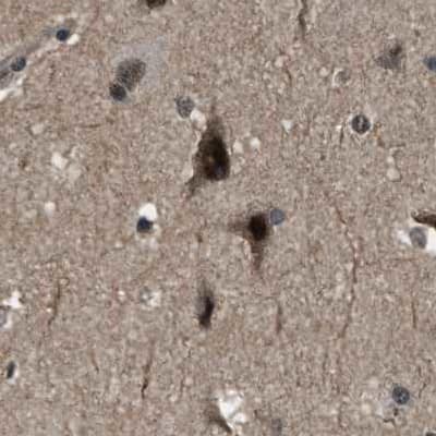 Immunohistochemistry-Paraffin SERTAD2 Antibody - BSA Free
