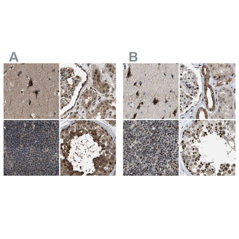 Immunohistochemistry-Paraffin SERTAD2 Antibody - BSA Free