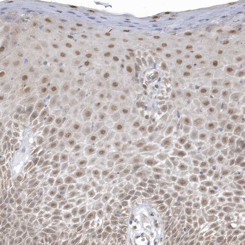 Staining of human skin shows weak to moderate nuclear positivity in squamous epithelial cells.