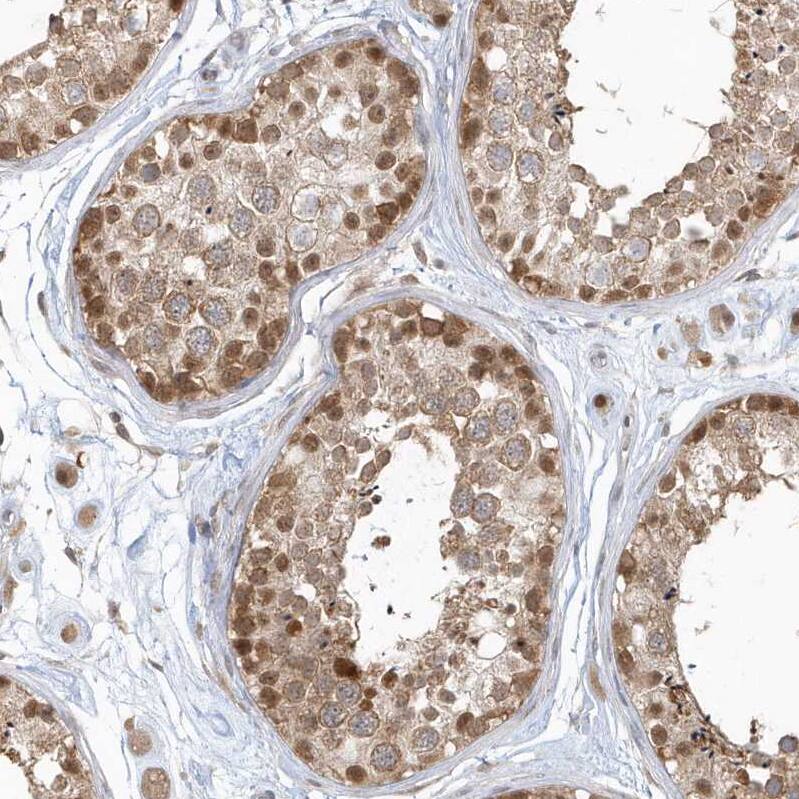 Staining of human testis shows moderate nuclear and cytoplasmic positivity in cells in seminiferous ducts.