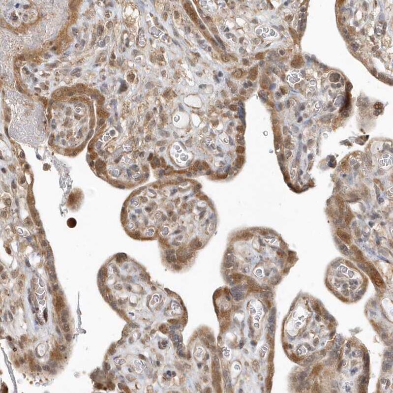 Staining of human placenta shows moderate cytoplasmic positivity in trophoblastic cells.